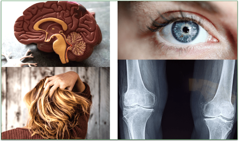 A model brain, a human eye, a woman holding her hair, and an x-ray of bones