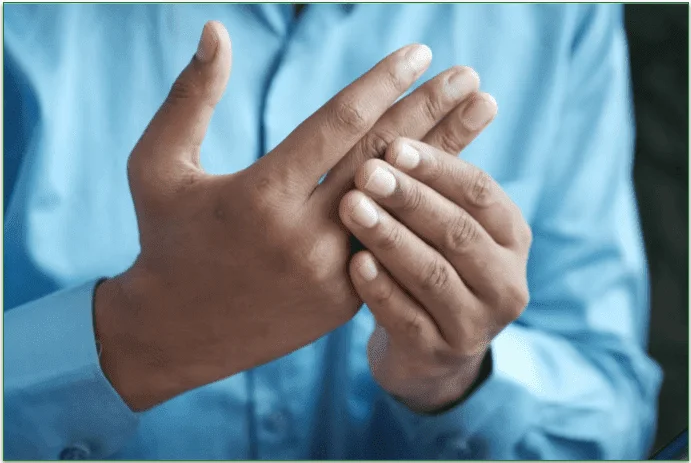 A person holding their fingers because of inflammation.