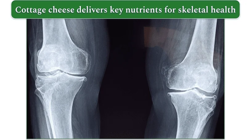 X-ray image of knees