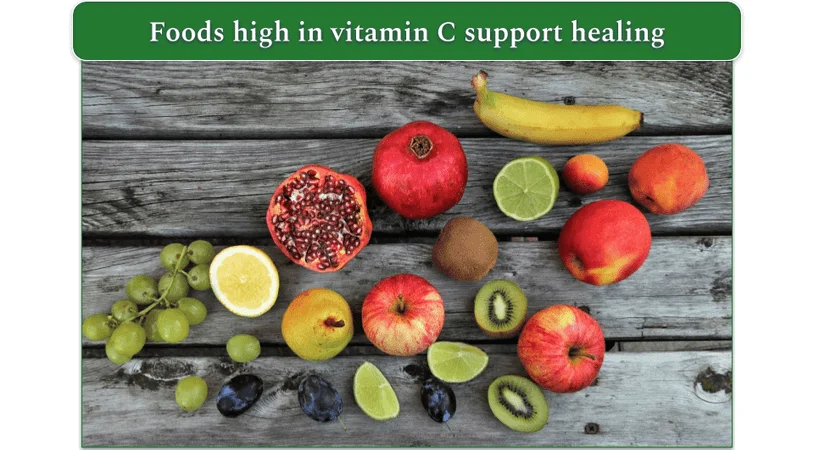 Fruits including lemon, kiwi, oranges, etc.